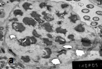 Электронная фотография микроколонии анаммокс-бактерий